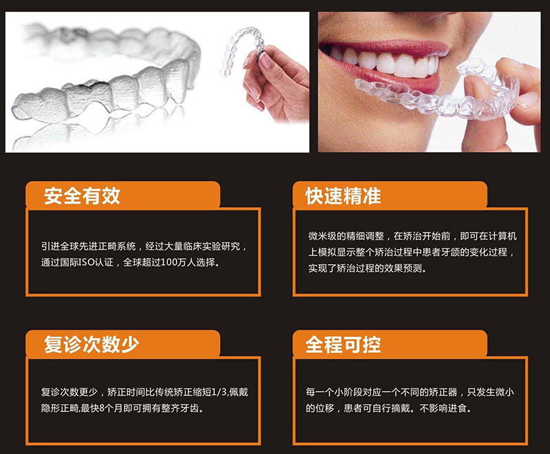 数字化隐形矫正